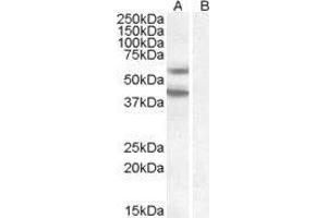 Western Blotting (WB) image for Diacylglycerol O-Acyltransferase 2 (DGAT2) peptide (ABIN369303) (Diacylglycerol O-Acyltransferase 2 (DGAT2) Peptid)