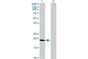 Western Blot analysis of C9orf6 expression in transfected 293T cell line by C9orf6 MaxPab polyclonal antibody. (C9orf6 Antikörper  (AA 1-181))