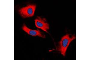 Immunofluorescent analysis of MMP13 staining in HeLa cells. (MMP13 Antikörper  (N-Term))