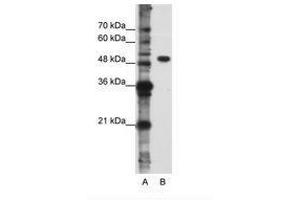 Image no. 1 for anti-DEAD (Asp-Glu-Ala-Asp) Box Polypeptide 47 (DDX47) (N-Term) antibody (ABIN6736231) (DDX47 Antikörper  (N-Term))