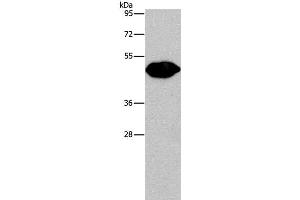 Western Blot analysis of Mouse brain tissue using PLIN2 Polyclonal Antibody at dilution of 1:680 (ADRP Antikörper)