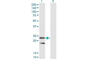 Western Blot analysis of SSR2 expression in transfected 293T cell line by SSR2 monoclonal antibody (M01), clone 4C1.
