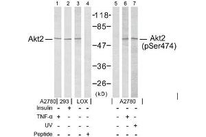 Image no. 2 for anti-V-Akt Murine Thymoma Viral Oncogene Homolog 2 (AKT2) (pSer474) antibody (ABIN196826) (AKT2 Antikörper  (pSer474))