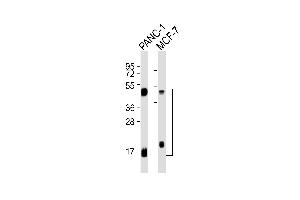 All lanes : Anti-Cathepsin D LC Antibody at 1:1000 dilution Lane 1: NC-1 whole cell lysates Lane 2: MCF-7 whole cell lysates Lysates/proteins at 20 μg per lane. (Cathepsin D Antikörper  (Light Chain))