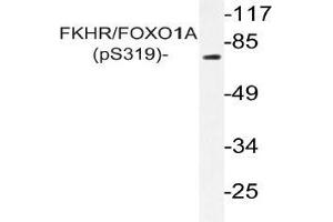 Western blot (WB) analysis of p-FKHR/FOXO1A antibody in extracts from HeLa cells (FOXO1 Antikörper  (pSer319))