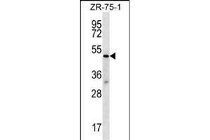 TBL2 Antibody (N-term) (ABIN656760 and ABIN2845981) western blot analysis in ZR-75-1 cell line lysates (35 μg/lane).