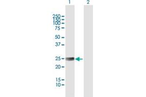 Western Blot analysis of ETHE1 expression in transfected 293T cell line by ETHE1 MaxPab polyclonal antibody.