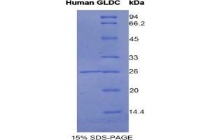 SDS-PAGE of Protein Standard from the Kit (Highly purified E. (GLDC CLIA Kit)