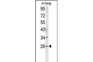 DNAJC8 Antikörper  (C-Term)