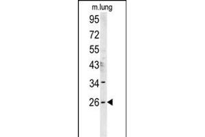 DNJC8 Antibody (C-term) (ABIN651765 and ABIN2840393) western blot analysis in mouse lung tissue lysates (15 μg/lane). (DNAJC8 Antikörper  (C-Term))