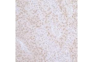 Immunohistochemistry (IHC) image for anti-LAP2 beta gamma/tmpo (AA 350-400) antibody (ABIN7455057) (LAP2 beta gamma/tmpo (AA 350-400) Antikörper)