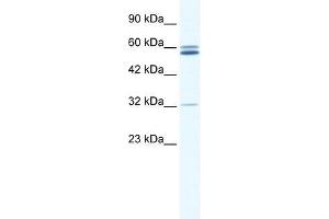 Western Blot showing ZNF491 antibody used at a concentration of 1-2 ug/ml to detect its target protein. (ZNF491 Antikörper  (N-Term))