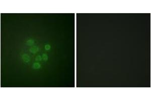 Immunofluorescence analysis of A549 cells, using MDM2 (Phospho-Ser166) Antibody. (MDM2 Antikörper  (pSer166))