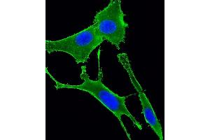 Immunofluorescence (IF) image for anti-Guanine Nucleotide Binding Protein (G Protein), alpha 11 (Gq Class) (GNA11) (AA 115-146) antibody (ABIN6243772)