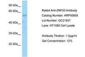 Image no. 1 for anti-Zinc Finger Protein 20 (ZNF20) (AA 449-498) antibody (ABIN6749920)