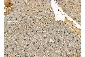 ABIN7095423 and ABIN7099480 at 1/100 staining rat brain tissue by IHC-P. (SCAI Antikörper)