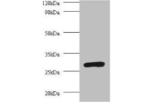 Western blot All lanes: PSMA7 antibody at 2 μg/mL + 293T whole cell lysate Secondary Goat polyclonal to rabbit IgG at 1/10000 dilution Predicted band size: 28, 21, 17 kDa Observed band size: 28 kDa (PSMA7 Antikörper  (AA 5-232))