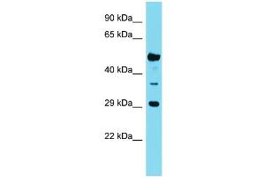 Host: Rabbit Target Name: OR6Q1 Sample Type: Fetal Kidney lysates Antibody Dilution: 1.