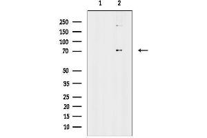 anti-Amyotrophic Lateral Sclerosis 2 (Juvenile) Chromosome Region, Candidate 11 (ALS2CR11) antibody