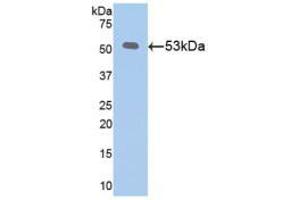 Western blot analysis of recombinant Mouse Klotho. (Klotho Antikörper  (AA 516-955))