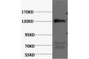 Western Blotting (WB) image for anti-Nitric Oxide Synthase 3 (Endothelial Cell) (NOS3) antibody (ABIN5961404) (ENOS Antikörper)