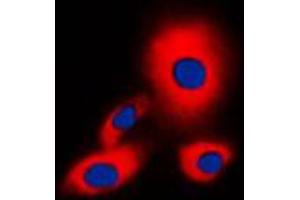 Immunofluorescent analysis of 14-3-3 zeta (pS58) staining in A549 cells. (14-3-3 zeta Antikörper  (pSer58))