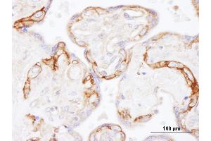Immunohistochemistry (IHC) image for anti-Epidermal Growth Factor Receptor (EGFR) (AA 1100-1150) antibody (ABIN7454623) (EGFR Antikörper  (AA 1100-1150))
