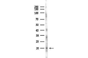 Western blot analysis of lysates from 293 cells(UV,30 min treatment), using PTP4/PRL1 Antibody at 1/1000 dilution.