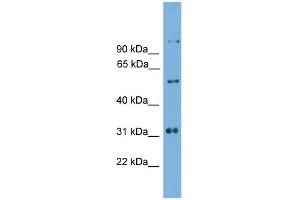 WB Suggested Anti-Irx2 Antibody Titration: 0. (IRX2 Antikörper  (C-Term))
