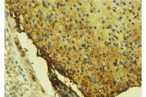ABIN6276681 at 1/100 staining Mouse liver tissue by IHC-P. (Coagulation Factor X Antikörper  (C-Term))
