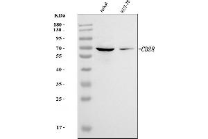 Western blot analysis of CD28 using anti-CD28 antibody (ABIN7600101).