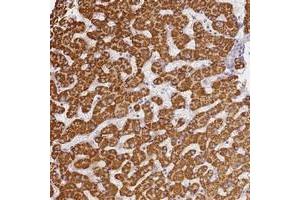 Immunohistochemical staining of human liver with SLC38A9 polyclonal antibody  shows strong cytoplasmic positivity in hepatocytes.