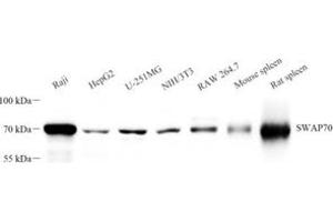 Western blot analysis of SWAP70 (ABIN7075775) at dilution of 1: 2000 (SWAP70 Antikörper)