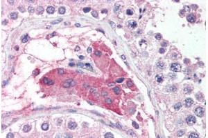 Human Testis (formalin-fixed, paraffin-embedded) stained with POU5F1 antibody ABIN625854 at 5 ug/ml followed by biotinylated goat anti-rabbit IgG secondary antibody ABIN481713, alkaline phosphatase-streptavidin and chromogen. (OCT4 Antikörper  (AA 114-163))