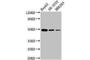 Western Blot Positive WB detected in: HepG2 whole cell lysate, SH-SY5Y whole cell lysate, HEK293 whole cell lysate All lanes: FDFT1 antibody at 3 μg/mL Secondary Goat polyclonal to rabbit IgG at 1/50000 dilution Predicted band size: 49, 41, 39, 36, 44 kDa Observed band size: 49 kDa (FDFT1 Antikörper  (AA 2-417))
