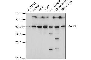 Western blot analysis of extracts of various cell lines, using GALK1 antibody. (GALK1 Antikörper)