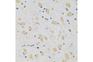 Immunohistochemistry of paraffin-embedded rat brain using CAMK1D Antibody (ABIN5975586) at dilution of 1/100 (40x lens). (CAMK1D Antikörper)