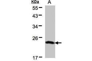 WB Image Sample(30 μg of whole cell lysate) A:H1299 12% SDS PAGE antibody diluted at 1:500 (BTF3 Antikörper)