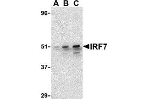 Western Blotting (WB) image for anti-Interferon Regulatory Factor 7 (IRF7) (C-Term) antibody (ABIN1030452)