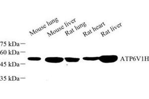 Western blot analysis of ATP6V1H (ABIN7073158) at dilution of 1: 500 (ATP6V1H Antikörper)