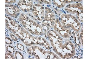 Image no. 4 for anti-Acetyl-CoA Acetyltransferase 2 (ACAT2) antibody (ABIN1496401) (ACAT2 Antikörper)