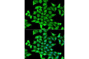 Immunofluorescence analysis of HeLa cell using SEPSECS antibody. (SEPSECS Antikörper)