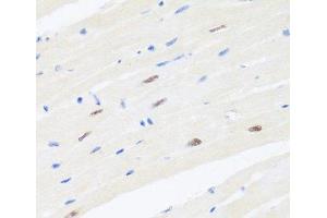 Immunohistochemistry of paraffin-embedded Mouse heart using BRMS1 Polyclonal Antibody at dilution of 1:100 (40x lens). (BRMS1 Antikörper)