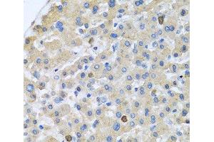 Immunohistochemistry of paraffin-embedded Human liver using APOA5 Polyclonal Antibody at dilution of 1:100 (40x lens). (APOA5 Antikörper)