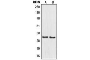 Western blot analysis of MRPL15 expression in PANC1 (A), HuvEc (B) whole cell lysates. (MRPL15 Antikörper  (Center))