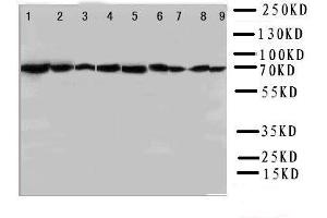 Lane 9: COLO320 Cell Lysate (Hsc70 Antikörper  (N-Term))