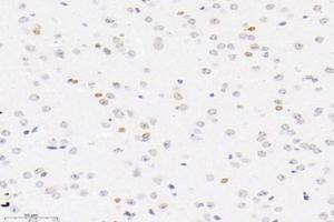 Immunohistochemistry analysis of paraffin-embedded mouse brain using,PLK5 (ABIN7075111) at dilution of 1: 4000 (PLK5 Antikörper)