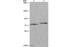 Western blot analysis of Mouse heart tissue and 231 cell, using AATF Polyclonal Antibody at dilution of 1:667 (AATF Antikörper)