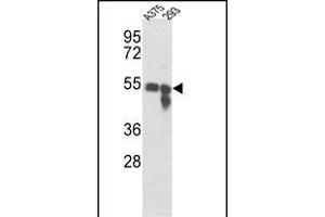 Western blot analysis of Tyrosinase Antibody (Center) (ABIN391521 and ABIN2841481) in , 293 cell line lysates (35 μg/lane). (TYR Antikörper  (AA 176-205))
