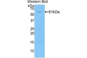 Western blot analysis of the recombinant protein. (FGL1 Antikörper  (AA 23-314))